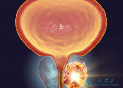 ǰ���ٰ����Ƴ��˰����������ж���³���Ͱ���³��