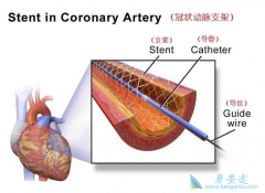 ��״����֧�ܺ���Χ����֧����ʲô������