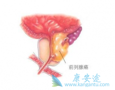 ǰ���ٰ��Ѿ���Ϊȫ�����Եڶ��󳣼��İ�֢��