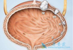 ��������������·��Ƥ����Ч��