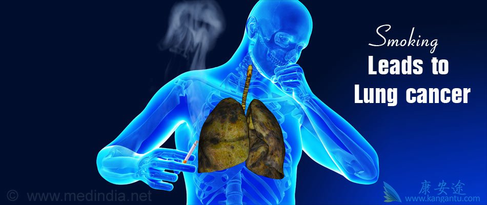 CAR-Tϸ�����Ʒ����봫ͳ��֢�Ʒ��������Щ�ŵ㣿