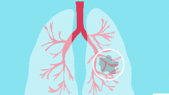 肺癌靶向药接力：从克唑替尼到Brigatinib