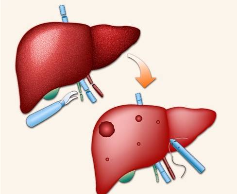 һ��Է����Ҹδ�������Ⱦ��