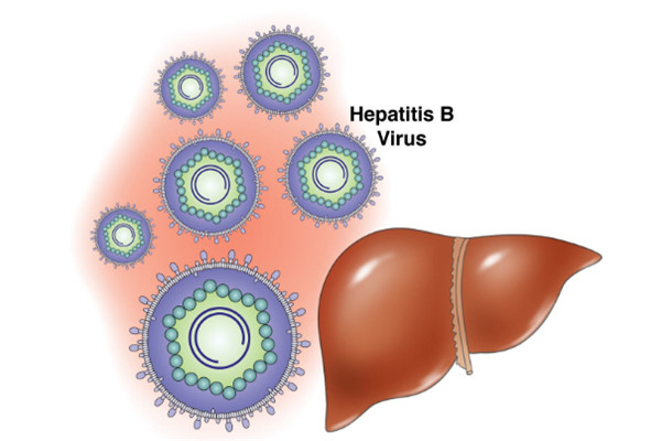 �Ҹ������������Ҹ�Ԥ������ѷ���