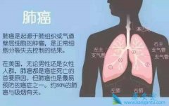 Ԥ���ΰ���Ҫ�˽�ΰ���ʲô֢״