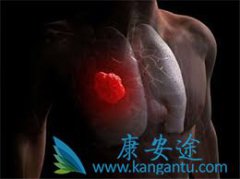 ����;ר�ҿ��շΰ��������κ���