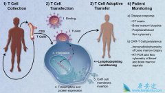 CAR-T�Ʒ�KYMRIAH��������ư�֢�ģ�
