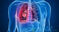 ��ʹ��Ѫ����˻���ǳ����ΰ����ڵ�֢״