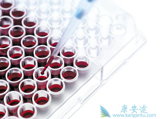 丙肝多长时间能治好 丙肝多长时间能治好