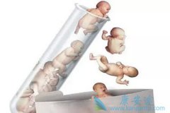 ѡ�������Թ�Ӥ��˫��̥�ļ����ǲ��Ǹ���