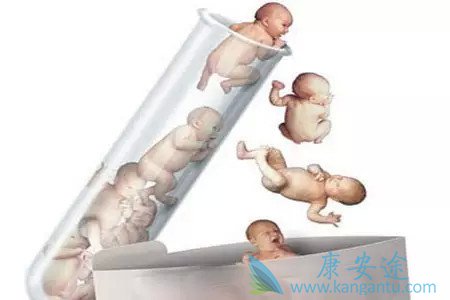 试管婴儿双胞胎 试管婴儿双胞胎